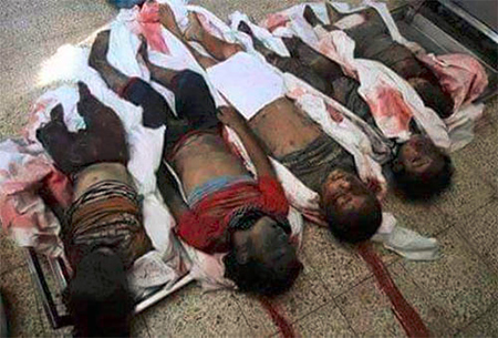 víctinas de los bombardeos de la Coalición Tormenta Decisiva de Arabia Saudí sigue masacrando al pueblo yemení