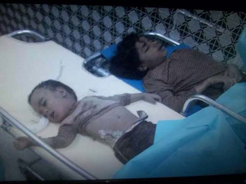 victimas de la agresión israeli Segundo día de agresión saudí contra Yemen