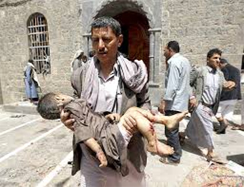 una víctima yemení de la aviación saudí Arabia Saudita encabeza una agresión contra el pueblo yemení