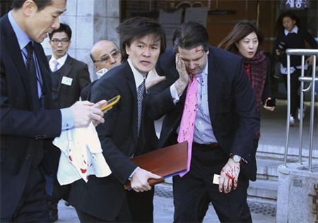 Mark Lippert sangrando tras el ataque Ataque al embajador de EEUU en Corea del Sur