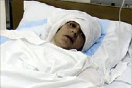 un niño herido por la explosión de una bomba de racimo israelí Crimen israelí con efecto retardado