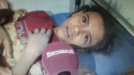 una de las víctimas de la agresión contra Yemen En el tercer día de la agresión, Washington rescata a dos pilotos saudíes