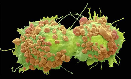 Científicos están más cerca de la cura del cáncer