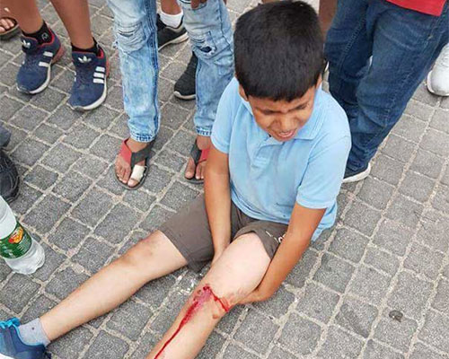 Un colono israelí atropella a cuatro niños palestinos Un colono israelí atropella a cuatro niños palestinos
