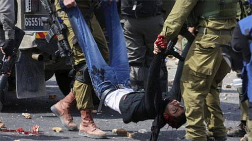 represión israelí en Palestina ocupada La represión israelí causa más de mil 250 heridos en Palestina
