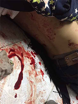 un herido El régimen de Al Jalifa derrama la sangre de sus ciudadanos en Bahréin