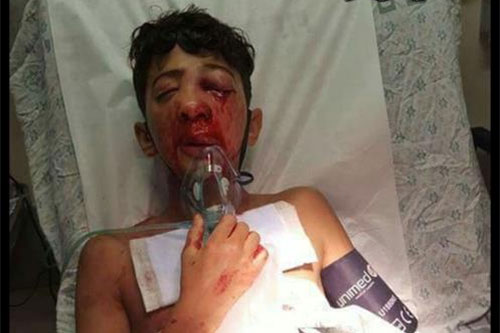 el adolescente palestino Nur Hamdan en el hospital La ocupación israelí “ciega la luz” de un ojo al palestino Nur