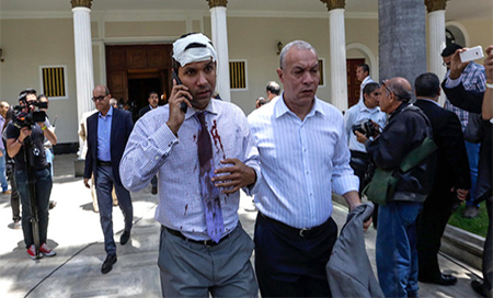 Un hombre herido habla por teléfono en el interior de la sede de la Asamblea Nacional Justicia de Venezuela castigará severamente a quienes atacaron a diputados