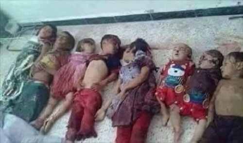 víctimas de la agresión saudí en Yemen Más de 13.000 civiles suman las víctimas de la devastadora agresión saudí en Yemen
