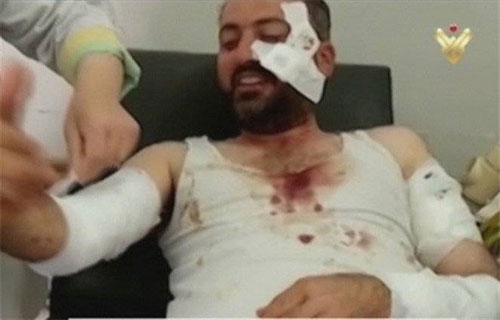 el cámara Mourhaf Mansour del canal de televisión Al Manar Dos cámaras y un reportero resultan heridos en el campo de Homs