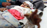 La situación en Yemen se agrava entre la agresión saudí y el cólera