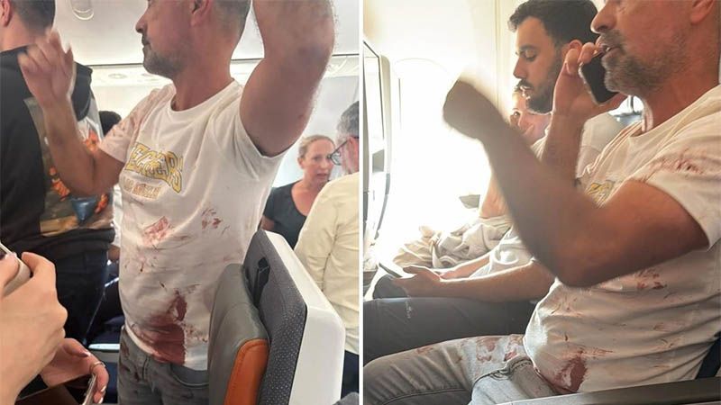 Difunden im&aacute;genes de un pasajero ensangrentado en el avi&oacute;n que declar&oacute; emergencia rumbo a Tel Aviv